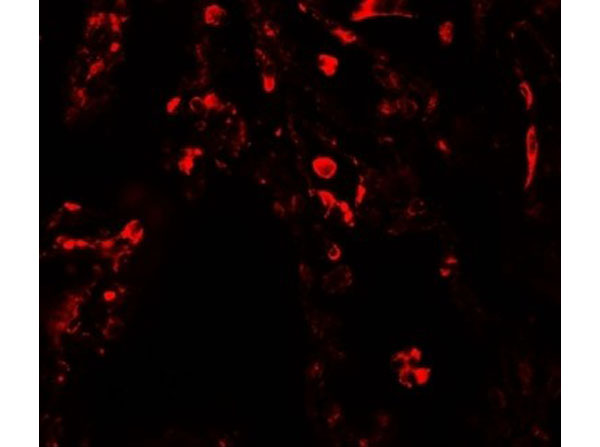 Immunofluorescence of SUZ12