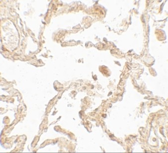Immunohistochemistry of SUZ12
