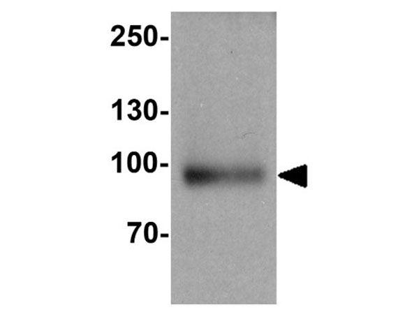 Western blot of SUZ12