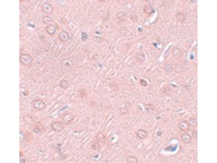 Immunohistochemistry of SYNGR2 Antibody