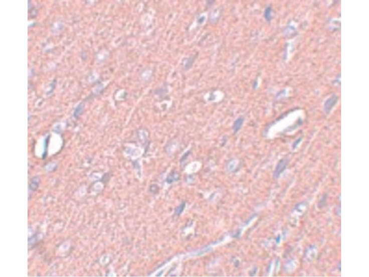 Immunohistochemistry of SYNGR3 Antibody