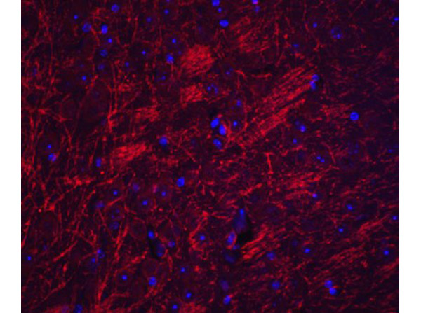 Immunofluorescence of SYNPO