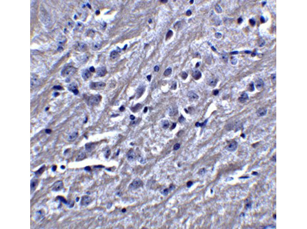 Immunohistochemistry of SYNPO