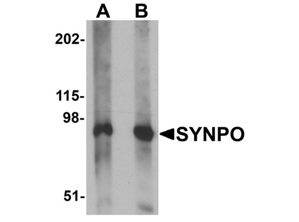 Western blot of SYNPO