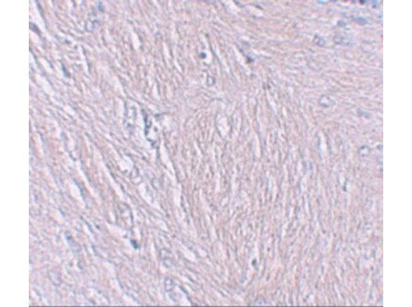 Immunohistochemistry of SYNPO