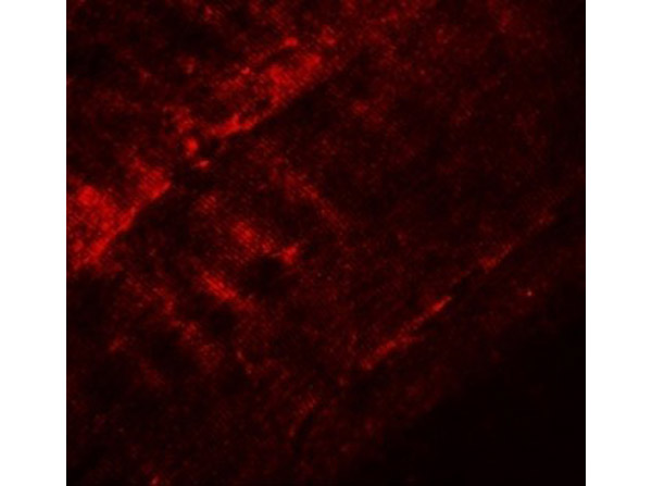Immunofluorescence of SYNPO2