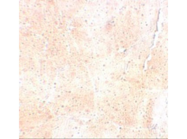 Immunohistochemistry of SYNPO2