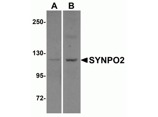 Western blot of SYNPO2