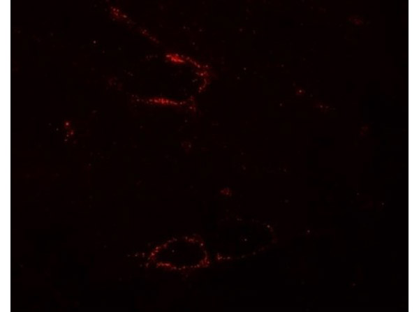 Immunofluorescence of SYNPO2L