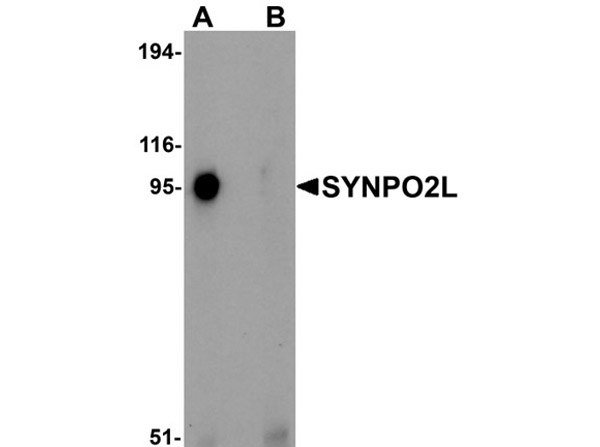 Western blot analysis of SYNPO2L