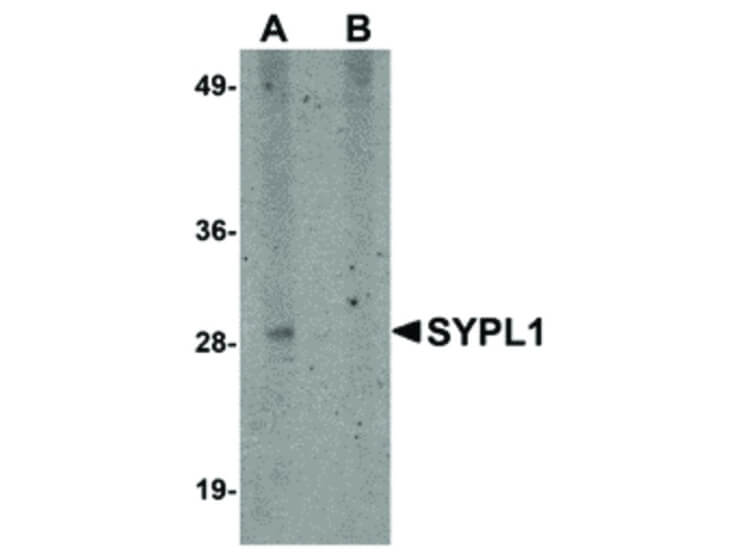 Western Blot of SYPL1 Antibody