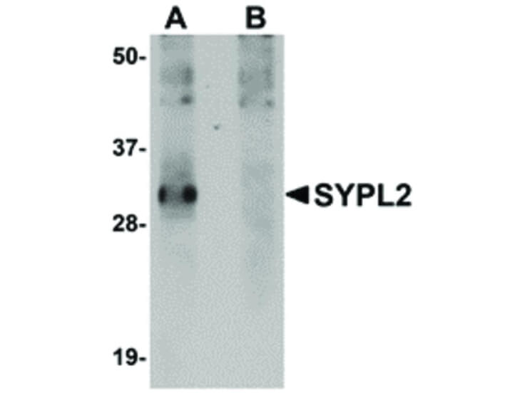Western Blot of SYPL2 Antibody