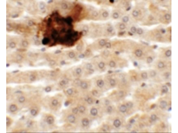 Immunohistochemistry of SYTL5