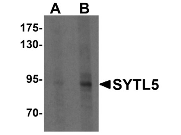 Western blot analysis of SYTL5