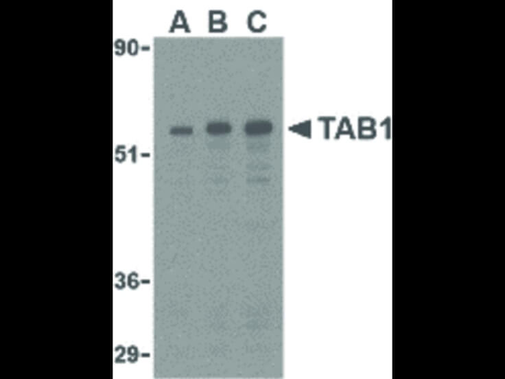 Western Blot of TAB1 Antibody