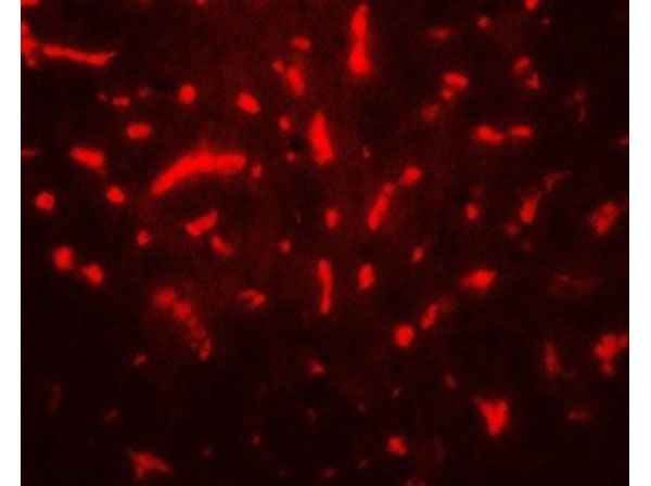 Immunofluorescence of TAF9