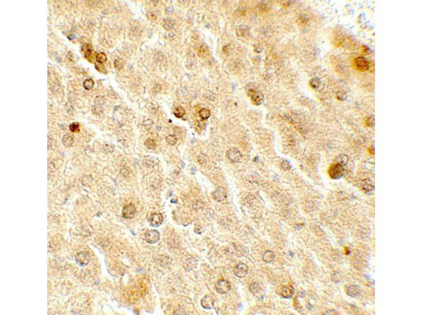 Immunohistochemistry of TAF9