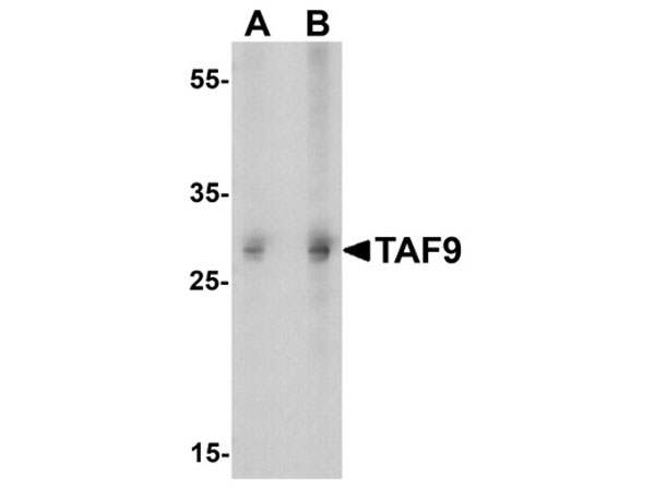 Western blot of TAF9