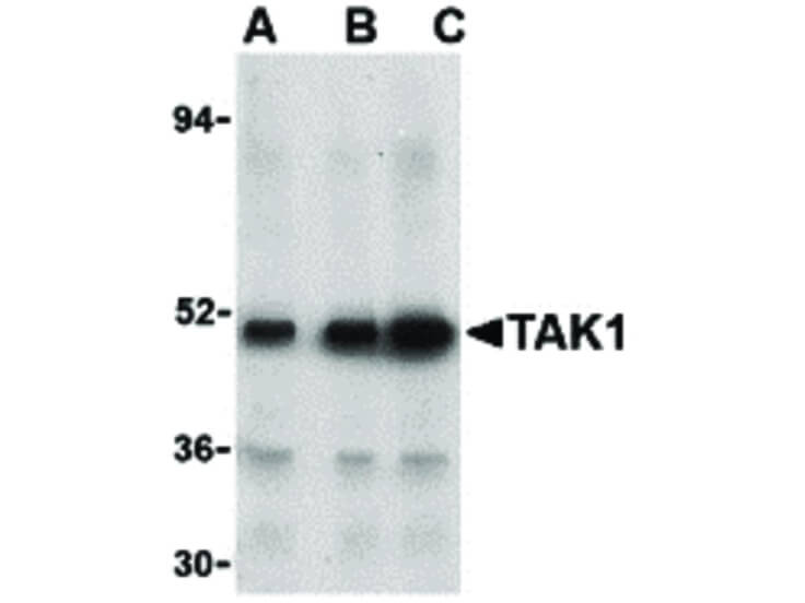 Western Blot of TAK1 Antibody