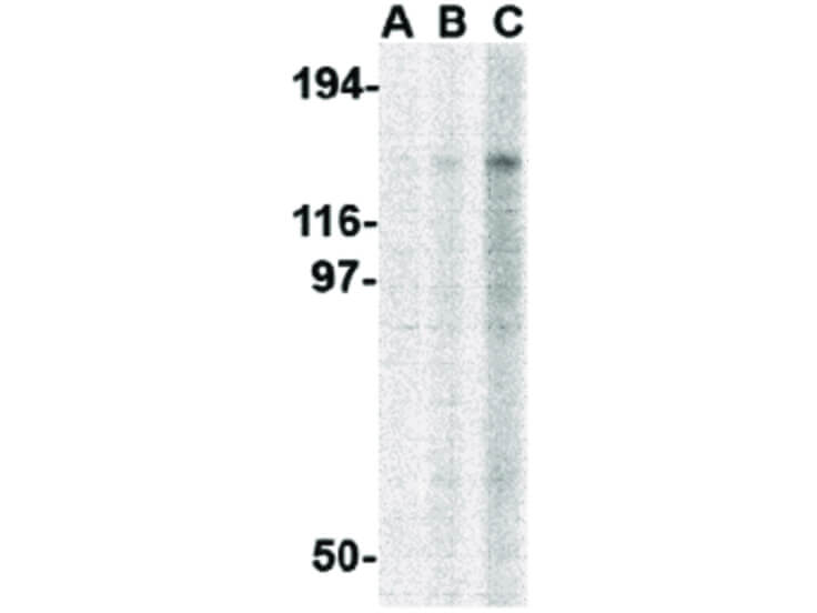 Western Blot of TBC1D1 Antibody