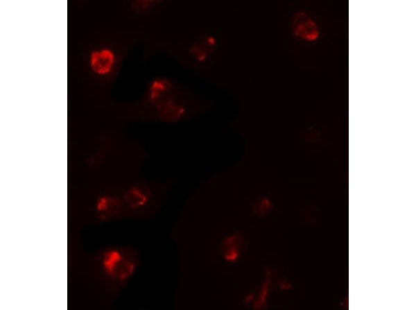 Immunofluorescence of TBX21