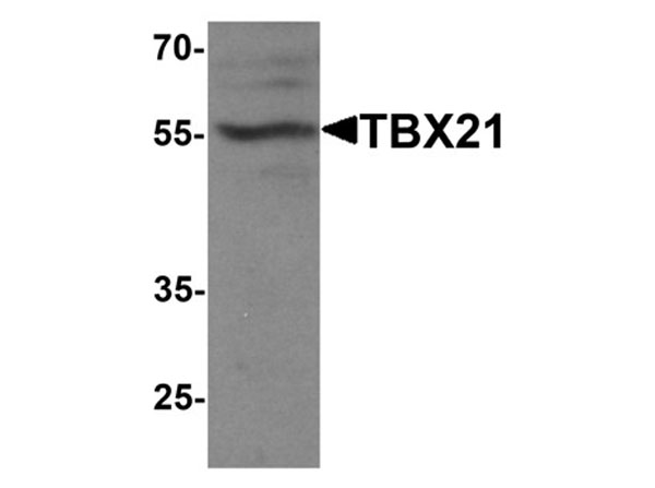 Western blot of TBX21