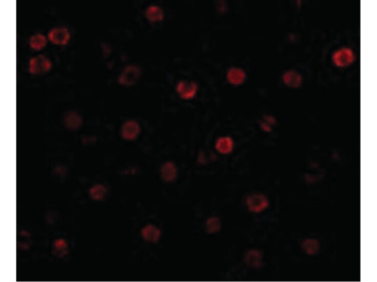 Immunofluorescence of T-cadherin Antibody