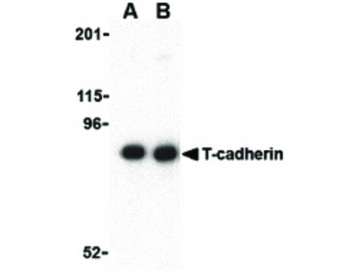Western Blot of T-cadherin Antibody