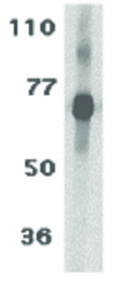 Western Blot of TCCR Antibody
