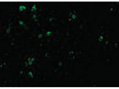 Immunofluorescence of TCCR Antibody