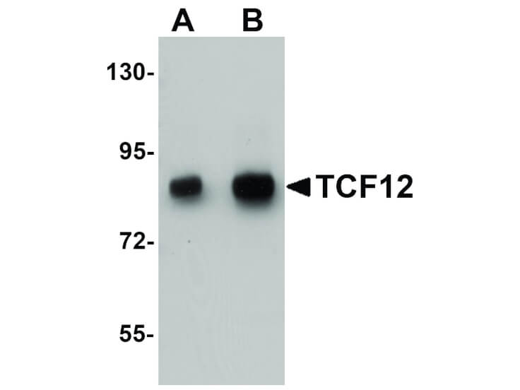 Western Blot of TCF12 Antibody