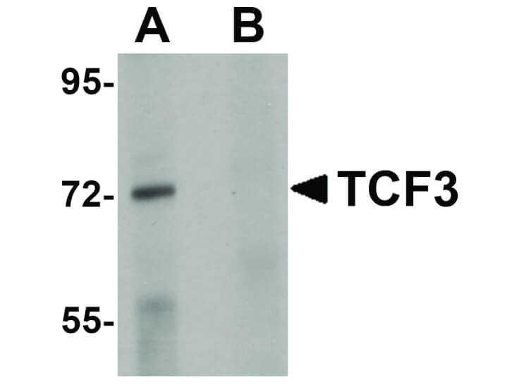 Western Blot of TCF3 Antibody