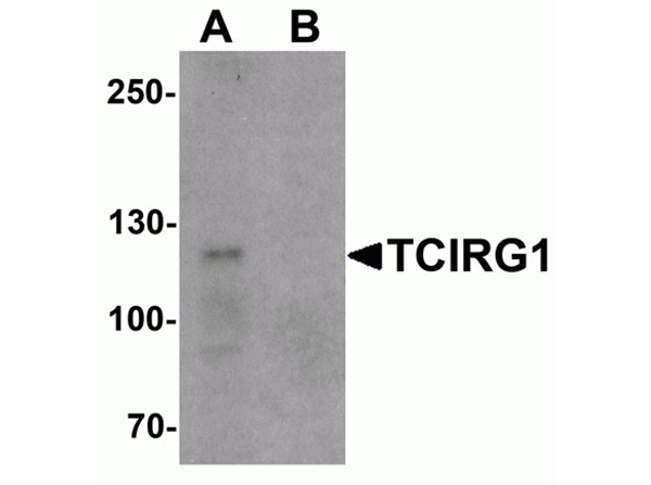 Western blot analysis of TCIRG1