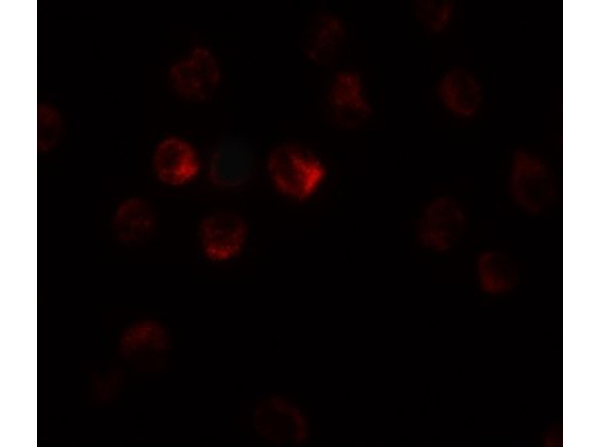 Immunofluorescence of TCTEX1D1