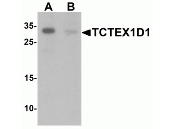 Western blot analysis of TCTEX1D1