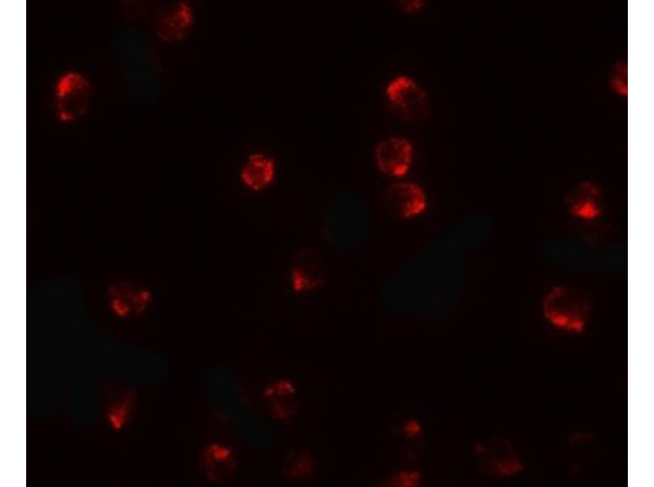 Immunofluorescence of TCTEX1D2