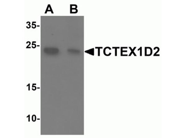 Western blot analysis of TCTEX1D2