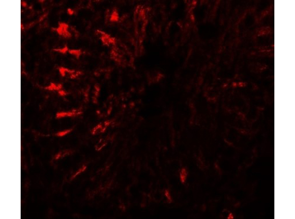 Immunofluorescence of TCTEX1D3