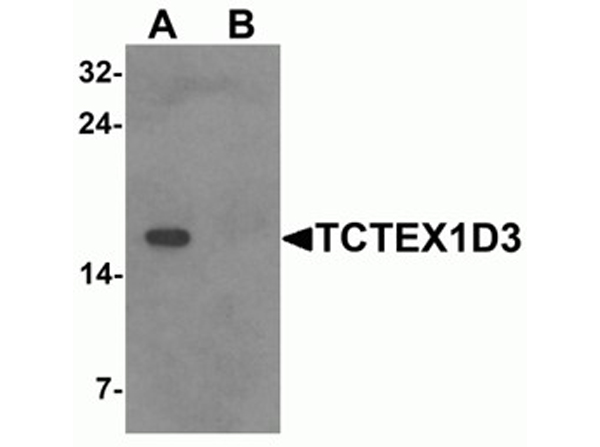Western blot analysis of TCTEX1D3.