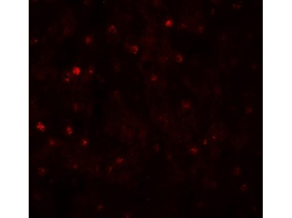 Immunofluorescence of TCTEX1D4