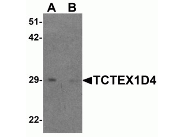 Western blot analysis of TCTEX1D4