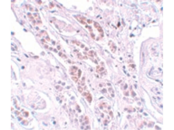 Immunohistochemistry of TCTN1 Antibody