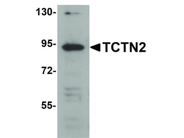 Western Blot of TCTN2 Antibody