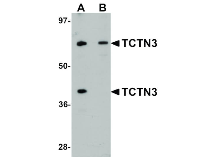 Western Blot of TCTN3 Antibody
