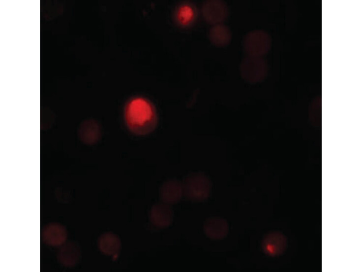 Immunofluorescence of TCTN3 Antibody