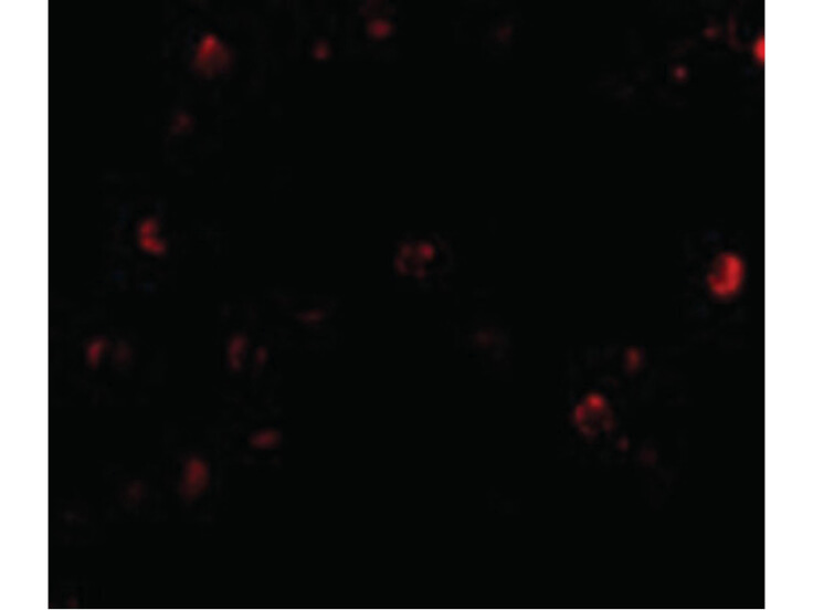 Immunofluorescence of TDP43 Antibody