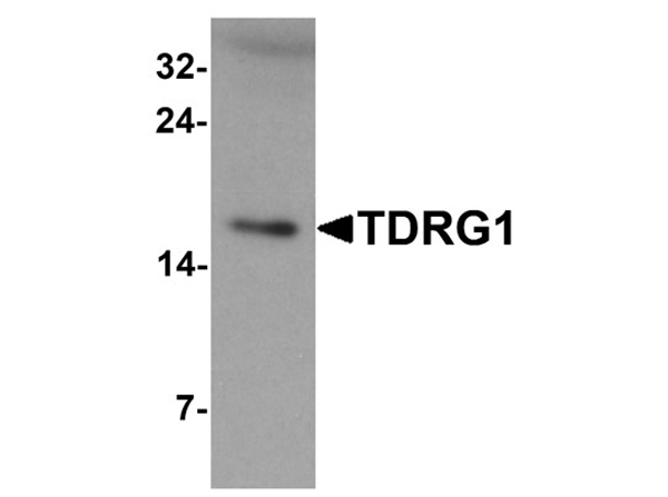 Western blot analysis of TDRG1