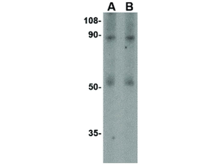 Western Blot of TEM1 Antibody