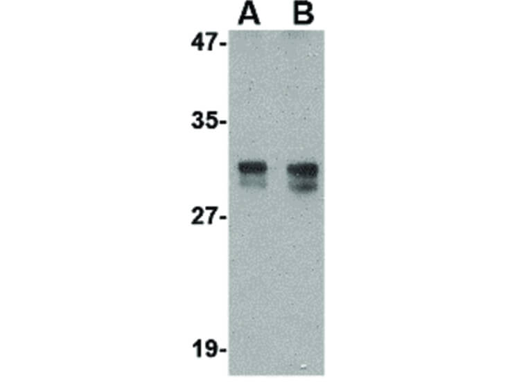 Western Blot of TEM2 Antibody