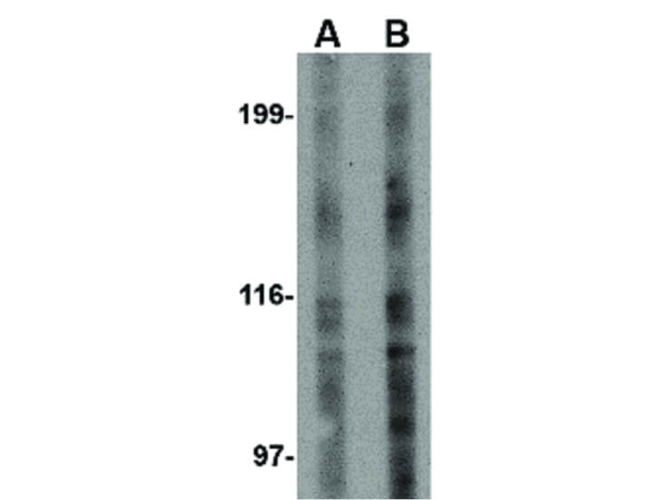 Western Blot of TEM4 Antibody